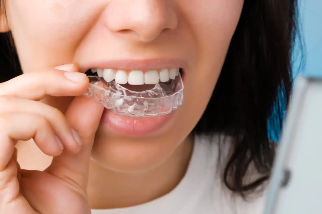 imgi 72 smiling woman with perfect healthy teeth using removable braces 1536x1023